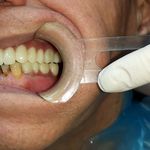 مطب ایمپلنت دکتر نیما شفیعی