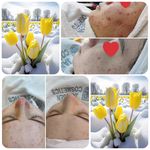 پاکسازی پوست وفیشال تخصصی فاطیما
