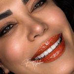 دکتر پریا اقاخانی،وام‌۱۵۰میلیونی دننالیت