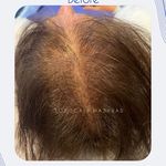 اولین مرکز میکرواسکالپ مشهد تاپ اسکالپ