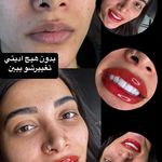 مرکز زیبایی نصیر