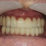 مطب ایمپلنت دکتر نیما شفیعی