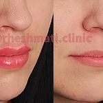 کلینیک پوست مو زیبایی دکتر حشمتی