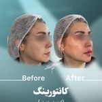 مطب پوست زيبايی ليزر دکتر شاه نعمت الهی