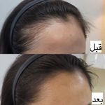 کلینیک پوست،مو،لیزر الیزا