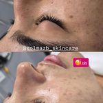 فیشال و پاکسازی تخصصی پوست سولماز