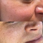 فرناز سعادت خدمات تخصصی فیشال و ریموو