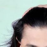 مرکز تخصصی لیزر آدخت ایرانیان