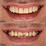 دندانپزشکی و ایمپلنت دکتر مهدی کریمی