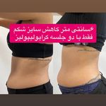 کلینیک زیبایی ،لیزر و لاغری گل مریم