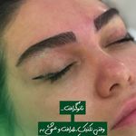 خدمات تخصصی کاشت ابرو منفرد