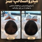 اولین مرکز اسکراپ و میکرواسکالپ در مشهد