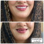 مجموعه دندان پزشکی و دندان سازی نچرال