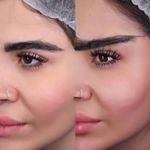کلینیک زیبایی الماس کاملا اقساطی