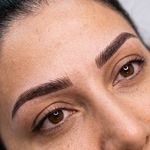 ریموو شیدینگ میکروبلیدینگ
