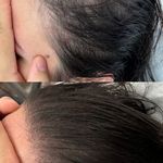 اجرای خدمات تتو صورت و بدن