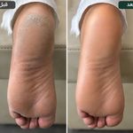 پدیکور و مانیکور اقایان نیاوران