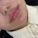 خدمات زیبایی با قیمت مناسب برای شما فیلر بوتاکس..
