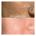 کلینیک زیبایی و لیزر مو زائد نوبا