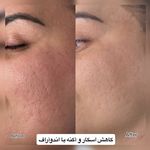 مرکز لیزر ،پوست و زیبایی کندی بیوتی
