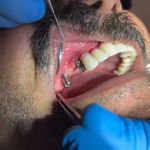 بیمه دندانپزشکی نوین سلامت در مشهد