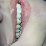 کلینیک دندانپزشکی دکترهمتی (بصورت اقساط)