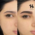 مرکز تخصصی میکروبلید ابرو شیدلب ریمو تتو