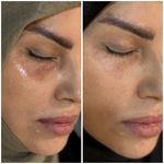کلینیک پوست، مو، لیزر و لاغری مهراز