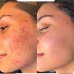 کلینیک فیشال و ماساژ سارن اسکین سارا