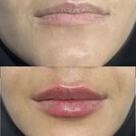 کلینیک زیبایی و بوتاکس گلبهار