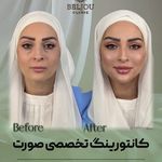 کلینیک زیبایی بلژو