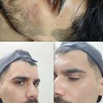 فیشال درمانی و پاکسازی پوست میرجلیلی