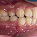 فتوگرافی پزشکی تکرنگ طب