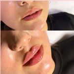 کلینیک پوست و زیبایی ژیلاوَش