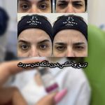 کلینیک لیزر و زیبایی سنسو