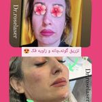 کلینیک زیبایی و لیزر دکتر رز