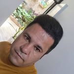 بهترین دکتر کاشت مو در بندرعباس، فاطمه سینایی