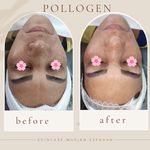 فیشال وپاکسازی تخصصی صورت و بدن اصفهان