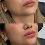 کلینیک پوست و زیبایی ژیلاوَش