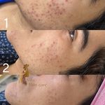 مرکز تخصصی پاکسازی پوست نیلو