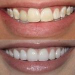 دندانپزشکی دکتر مهنوش محسنیان