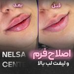 مطب زیبایی دکتر نلسا