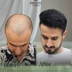 کلینیک زیبایی بلژو