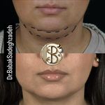 مرکز زیبایی دکتر بابک صادق زاده