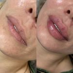 کلینیک زیبایی کیمیا اکسیر