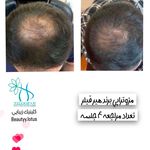 کلینیک پوست و مو و لیزر نیلوفر آبی