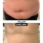 مرکز زیبایی رادا