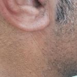 شنوایی سنجی هیلا سمعک