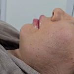 کلینیک زیبایی و لیزر مو  گندم