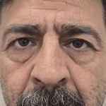 مطب زیبایی و لیزر دکتر علی  پاسبانی
